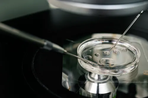 oplodnja, laboratorij, pretrage, mikrobiološki, nalaz, kultura, bakterije, virus, virusi, bakterija, bolest, trudnoća, Microscope,For,In,Vitro,Fertilization,Process,Close,Up.,.,Equipment