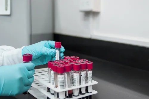 laboratorij, krvni test